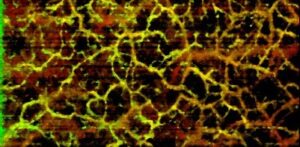 Cobra-S OCT angiography